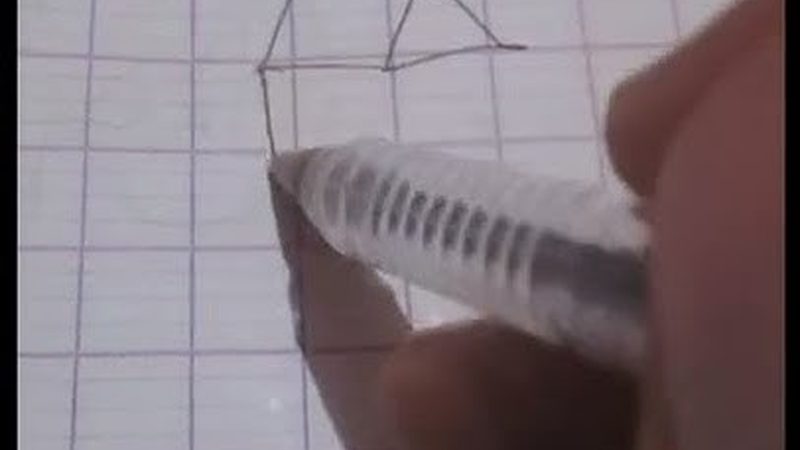 半口种植牙，老年人恢复期有多长？**